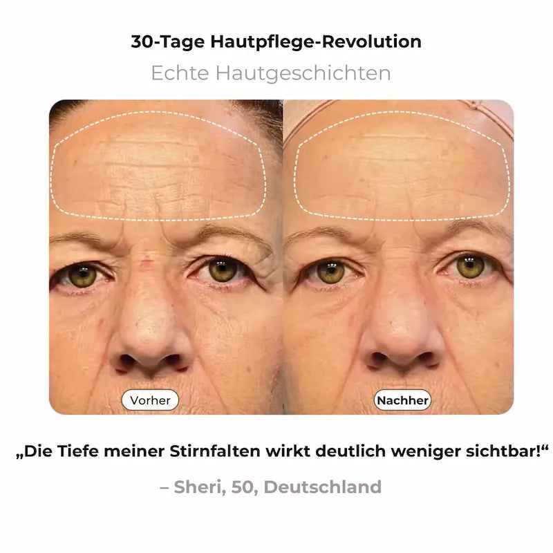 NAVAÉ PhotonSkin™ LED Maske