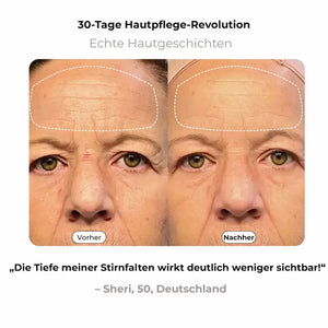 NAVAÉ PhotonSkin™ LED Maske